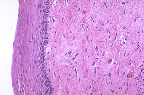 Odessa viloyati, Teplodar shahrida jinsiy aloqa