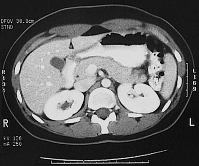 abdomen abdominal