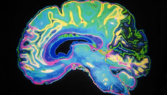 מחקר חדש מראה כי עלייה בחלבון טומוזין במוח עשויה להיות קשורה עם מחלות דגנרטיביות כדוגמת אלצהיימר