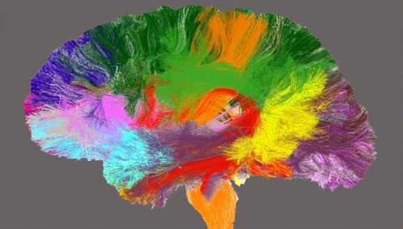 אטלס של המוח האנושי