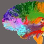 אטלס של המוח האנושי