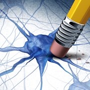 מחקר חדש קושר בין ליקוי במנגנון מרכזי בתאי המוח למחלת הסכיזופרניה