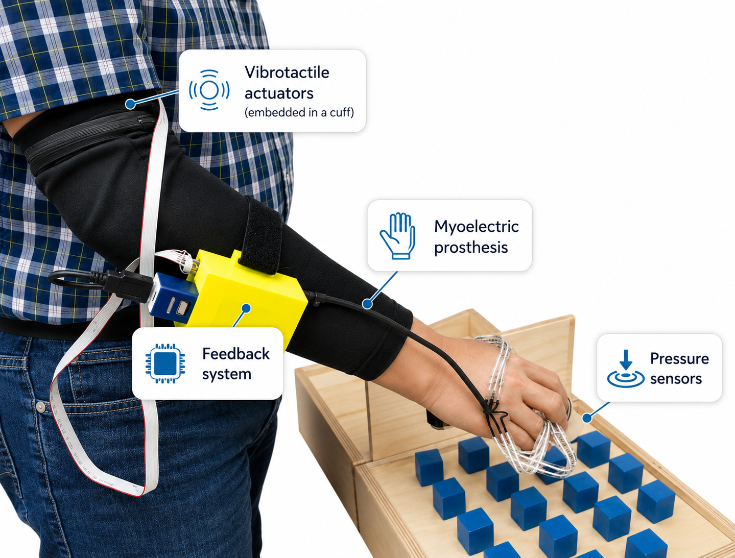 Transradial myoelectric prosthesis equipped with vibrotactile feedback system: vibrotactile actuators embedded in an arm cuff, feedback system unit, myoelectric prosthesis, and pressure sensors on the fingers, shown grasping wooden blocks