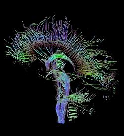 Diffusion tensor image of a human brain after white matter tractography